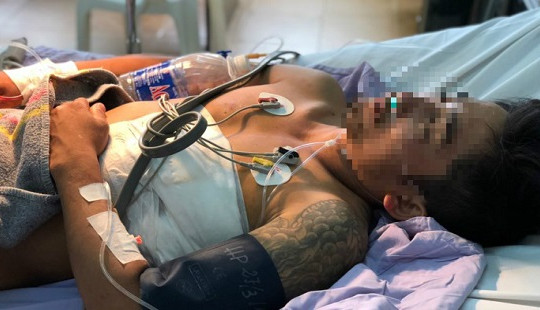 60 phút "cân não" cứu sống người đàn ông bị đâm thủng tim