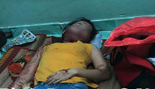 Một phụ nữ bị chồng chém trong phòng trọ