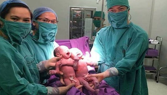 Niềm vui chào đón 2 bé sinh đôi cùng trứng nhờ thụ tinh ống nghiệm