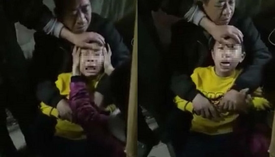 Thực hư clip bé trai phát tiếng chó sủa sau khi bị chó dại cắn