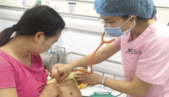 Bệnh sởi gia tăng ở Hà Nội