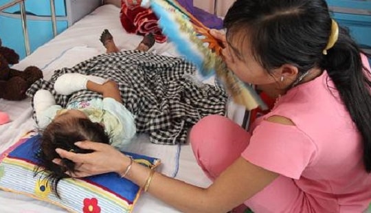 Sau đêm sốt, bé gái 3 tuổi phải cắt cụt tứ chi do bị hoại tử hiếm gặp