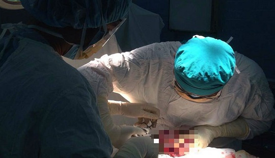 Nín thở ca phẫu thuật khối u 6kg cho bệnh nhân HIV