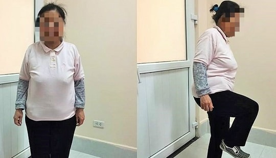Tự ý chữa đau chân, người phụ nữ 20 năm phải "chung sống" với thuốc giảm đau