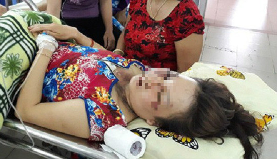 Bị sét đánh trúng dây chuyền, người phụ nữ thoát chết hy hữu