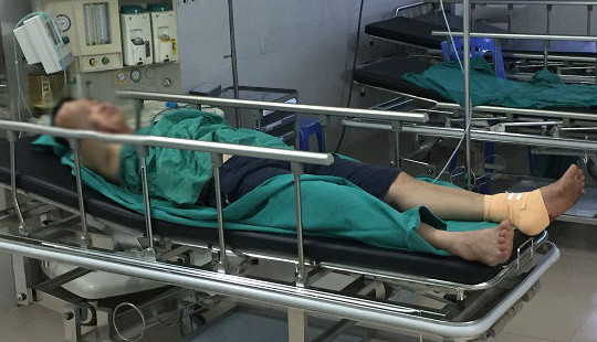 Điều tra nhóm đối tượng hành hung, cắt gân gót chân phụ xe khách
