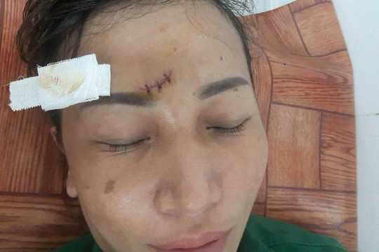 Hà Nội: Nữ công nhân vệ sinh môi trường bị đánh nhập viện