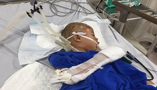 Bé trai 9 tuổi bị đối tượng nghi "ngáo đá" chém trọng thương