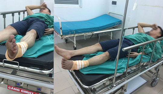 Khởi tố vụ nhân viên phụ xe bị nhóm đối tượng hành hung, cắt gân chân