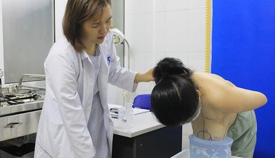 Người phụ nữ khốn khổ vì khó thở, lệch cột sống do bộ ngực to gấp 6 lần