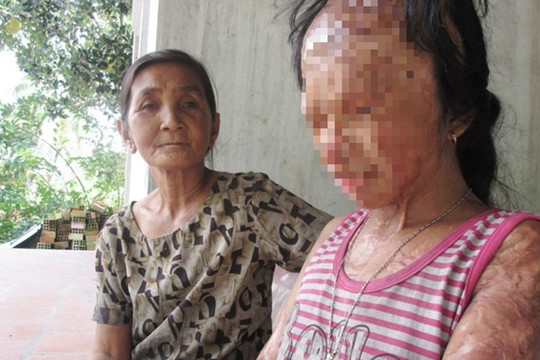 Bà nội muốn xin đôi mắt của Nguyễn Hữu Tình cho cháu gái bất hạnh