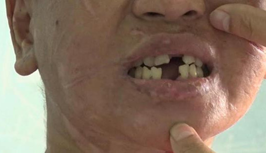 Đối tượng “hành hạ người ở” như thời trung cổ ở Gia Lai có thể đối mặt những tội danh nào?