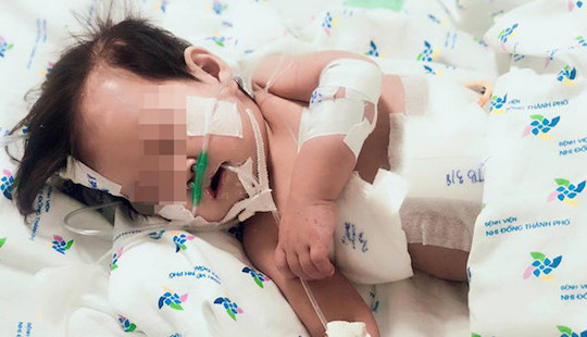 Bé 10 tháng mang 2 loại siêu vi khuẩn kháng tất cả kháng sinh