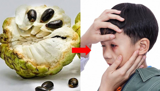 Bỏng giác mạc vì đập hạt na gội đầu