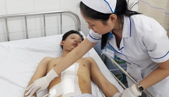 Bị vỡ gan, tràn máu vào ổ bụng sau tai nạn giao thông
