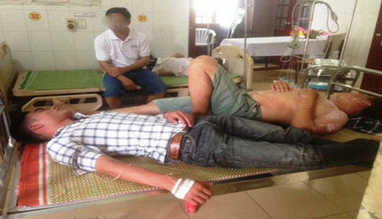 Nghệ An: 11 người thương vong do bị ong vò vẽ đốt
