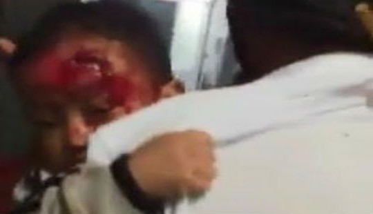 Phê bình rút kinh nghiệm kíp trực trong vụ bố bé con đi tìm bác sĩ trong bệnh viện