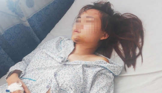 Hé lộ nguyên nhân vụ nữ giáo viên mầm non bị chồng chém nhập viện