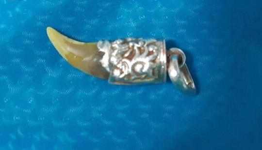 Nuốt nanh hổ trên sợi dây chuyền vào bụng, bé 23 tháng tuổi nhập viện cấp cứu