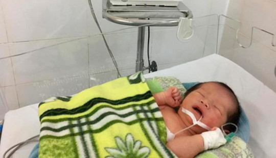 Cấp cứu thành công thai nhi ngôi ngược thò chân ra ngoài