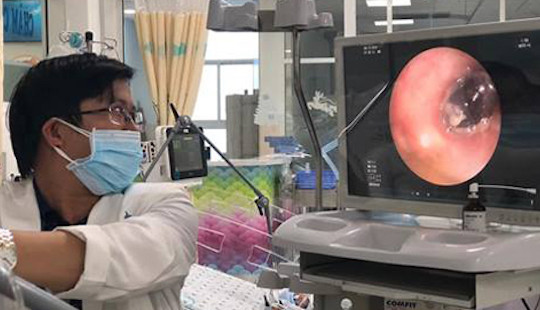 Bé 3 tuổi ngưng tim, suýt mất mạng vì hóc hạt mãng cầu