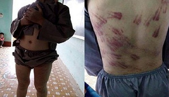 Công an vào cuộc vụ bé trai 10 tuổi bị sư thầy bạo hành