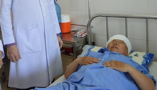Người phụ nữ bị máy xay xát cuốn lóc toàn bộ da đầu