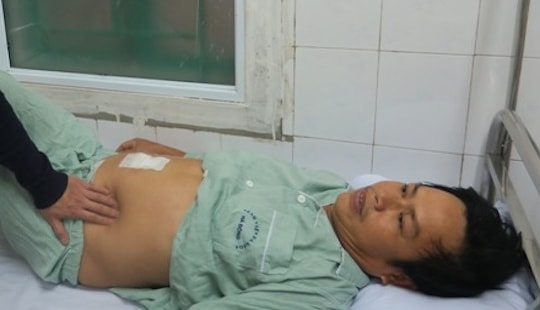 Mổ ruột thừa, bất ngờ phát hiện xương cá đâm thủng ruột non