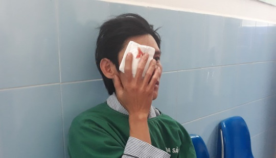 Xem đốt pháo, người đàn ông bị hỏng một mắt