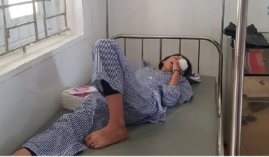 Bình thí nghiệm phát nổ, nữ sinh lớp 8 rách giác mạc