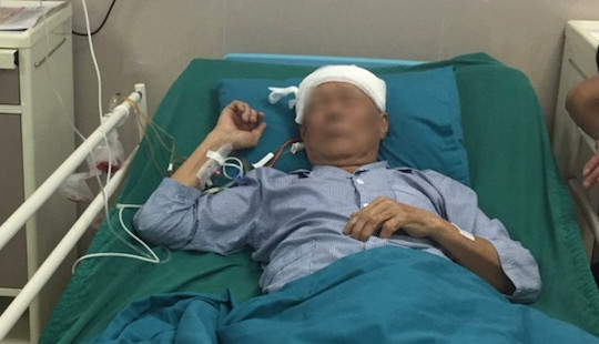 Cụ ông 91 tuổi nói chuyện với bác sĩ suốt ca mổ não