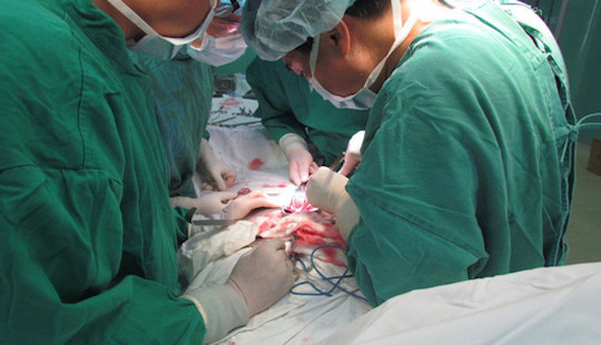 Lần đầu tiên thực hiện tắc mạch trước khi mổ lấy u thận