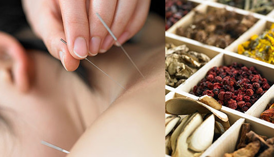 Quy định việc thực hiện điều trị nội trú ban ngày tại cơ sở KCB y học cổ truyền