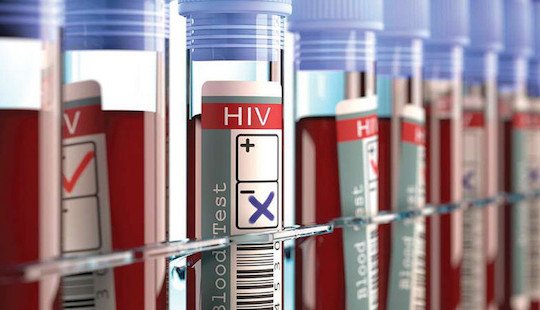 Người thứ 3 trên thế giới được chữa khỏi HIV