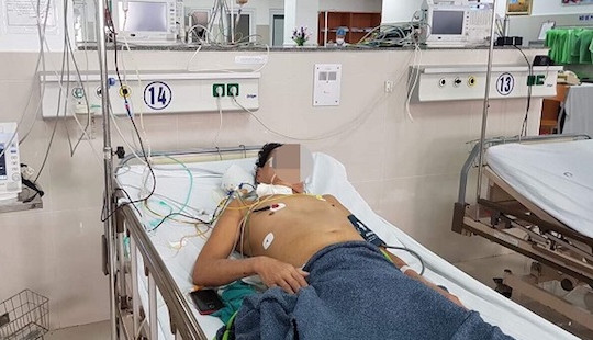 Hút 2 lít máu trong ổ bụng người đàn ông bị vỡ u gan