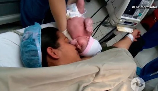 Bé sơ sinh vừa chào đời đã mang bào thai trong bụng