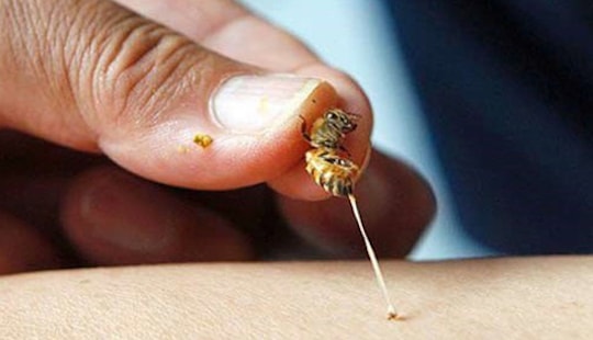 Chủ quan với vết ong đốt, người phụ nữ suýt mất mạng