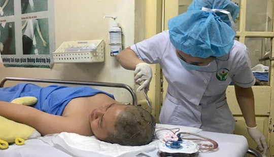 Nam sinh bị cọc sắt cắm vào đầu trong giờ học thể dục phải mổ tạo hình sọ não