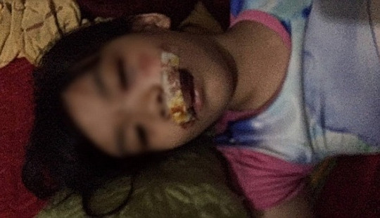 5 người ở Hà Tĩnh bị chó điên lao ra cắn khi đang đi đường