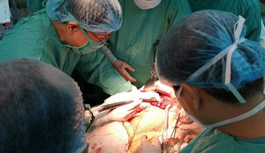 Lần đầu cắt gan bằng kỹ thuật bảo tồn phần gan cắt bỏ