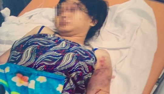 Bắt giữ nữ nghi phạm vụ bắt cóc, tra tấn thai phụ