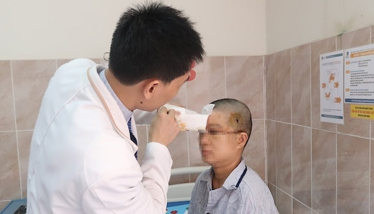 Nữ công nhân bị máy dệt cuốn tóc, lóc toàn bộ da đầu