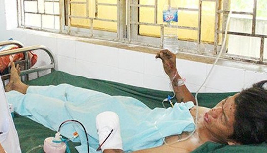 Dùng điện thoại khi sạc, nam thanh niên bị nổ nát bàn tay