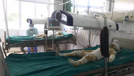 Tình trạng sức khỏe 3 trẻ mầm non bị bỏng khi học phòng chống cháy nổ