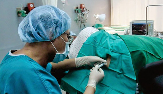 Hà Nội chấn chỉnh việc sử dụng phương pháp vô cảm trong mổ lấy thai