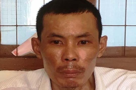 Người chồng đổ xăng đốt vợ bị khởi tố thêm tội danh