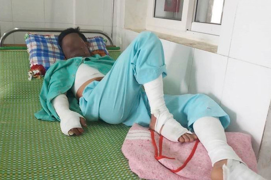 Điện thoại phát nổ khi đang sạc pin, nam thanh niên bị dập tay, bỏng nặng