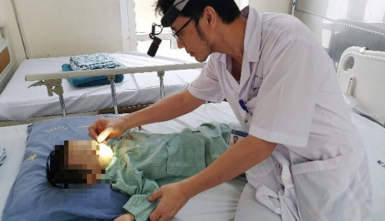 Bé 2 tuổi bỏng nặng do mẹ bất cẩn nhỏ nhầm axit vào mũi