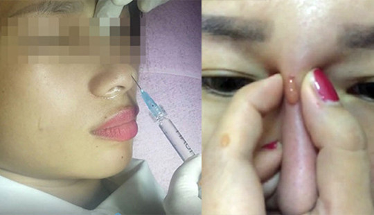 Làm đẹp siêu tốc: Đừng biến mình thành "vật thí nghiệm"