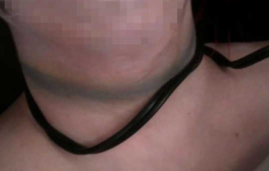 Dùng dây điện siết cổ bạn gái vì ghen
